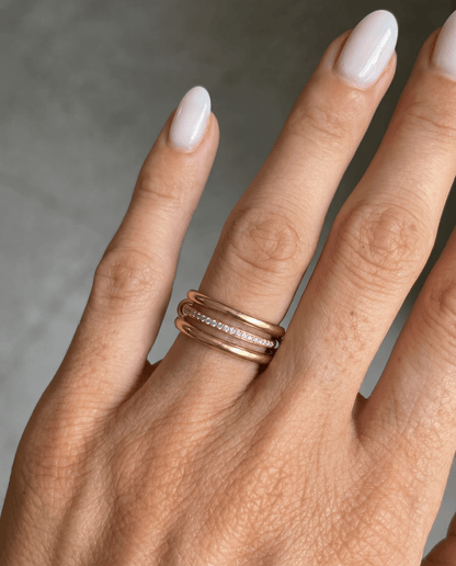 Spina ring